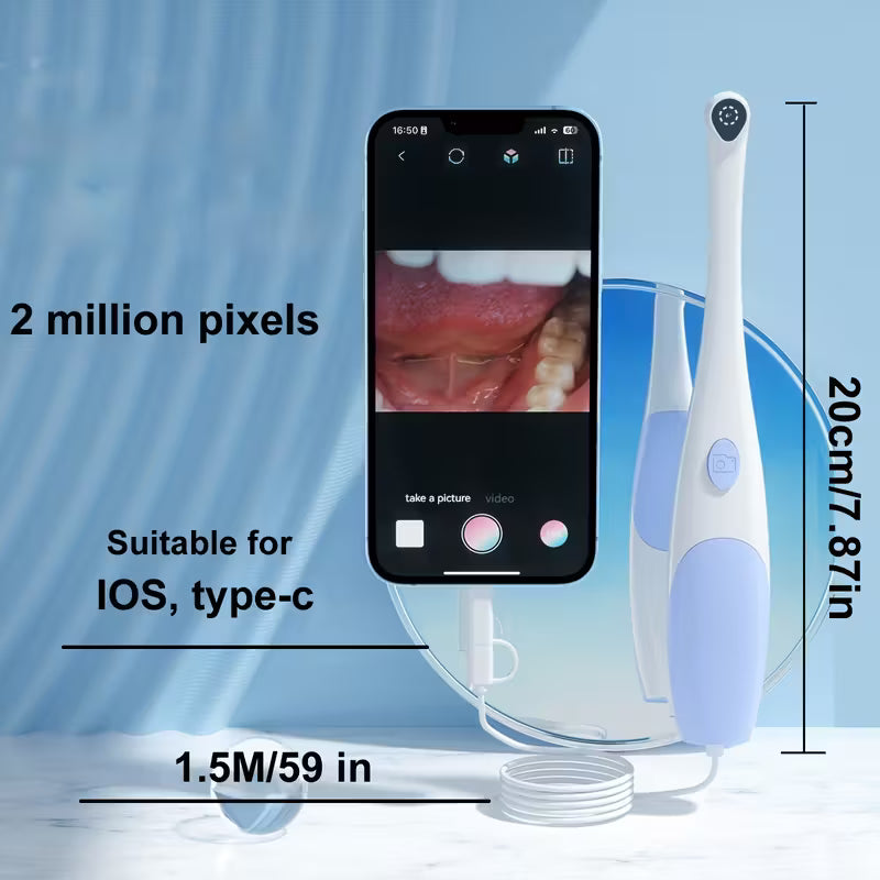 HD Oral Endoscope