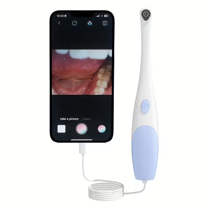 HD Oral Endoscope