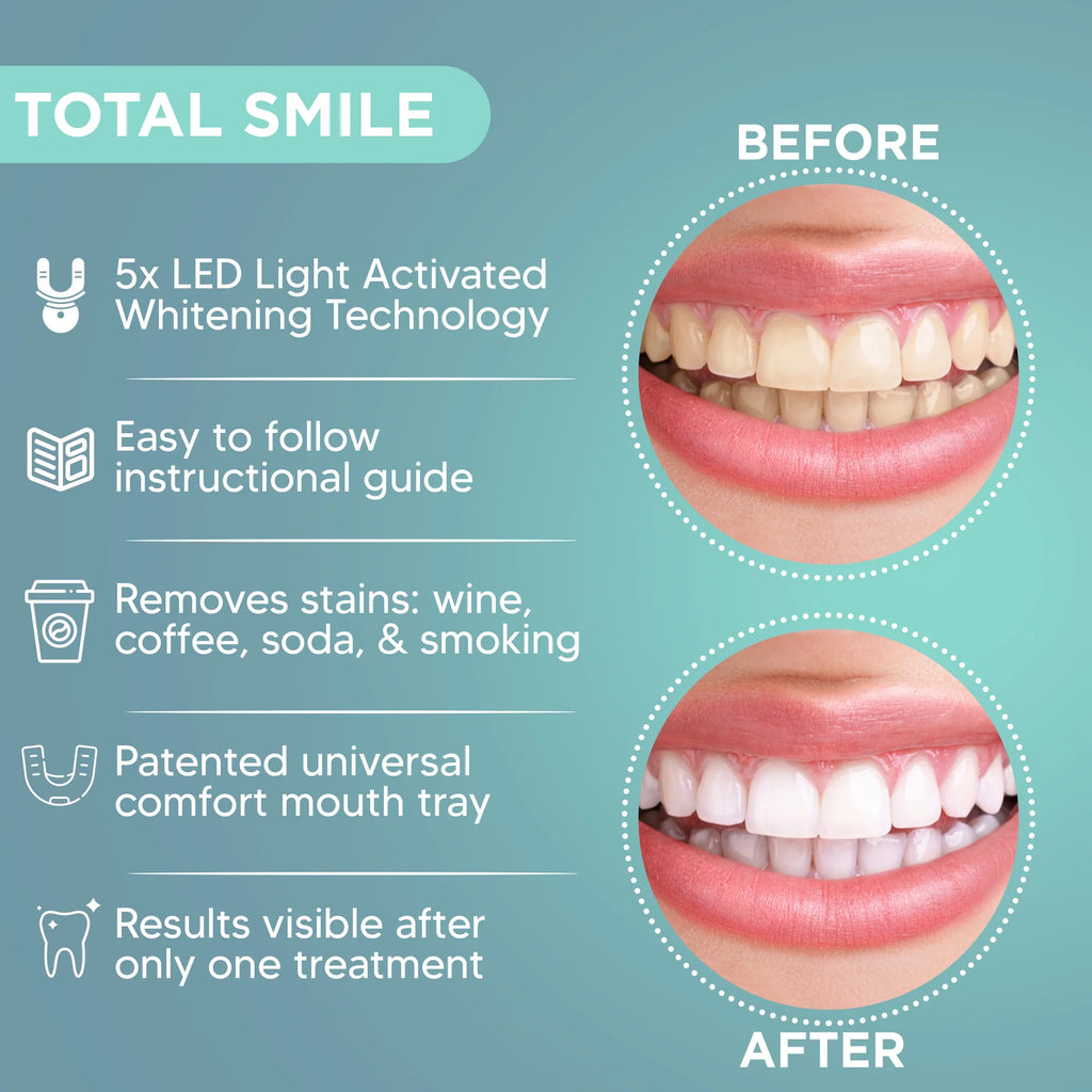Total Smile Advanced LED Whitening Kit
